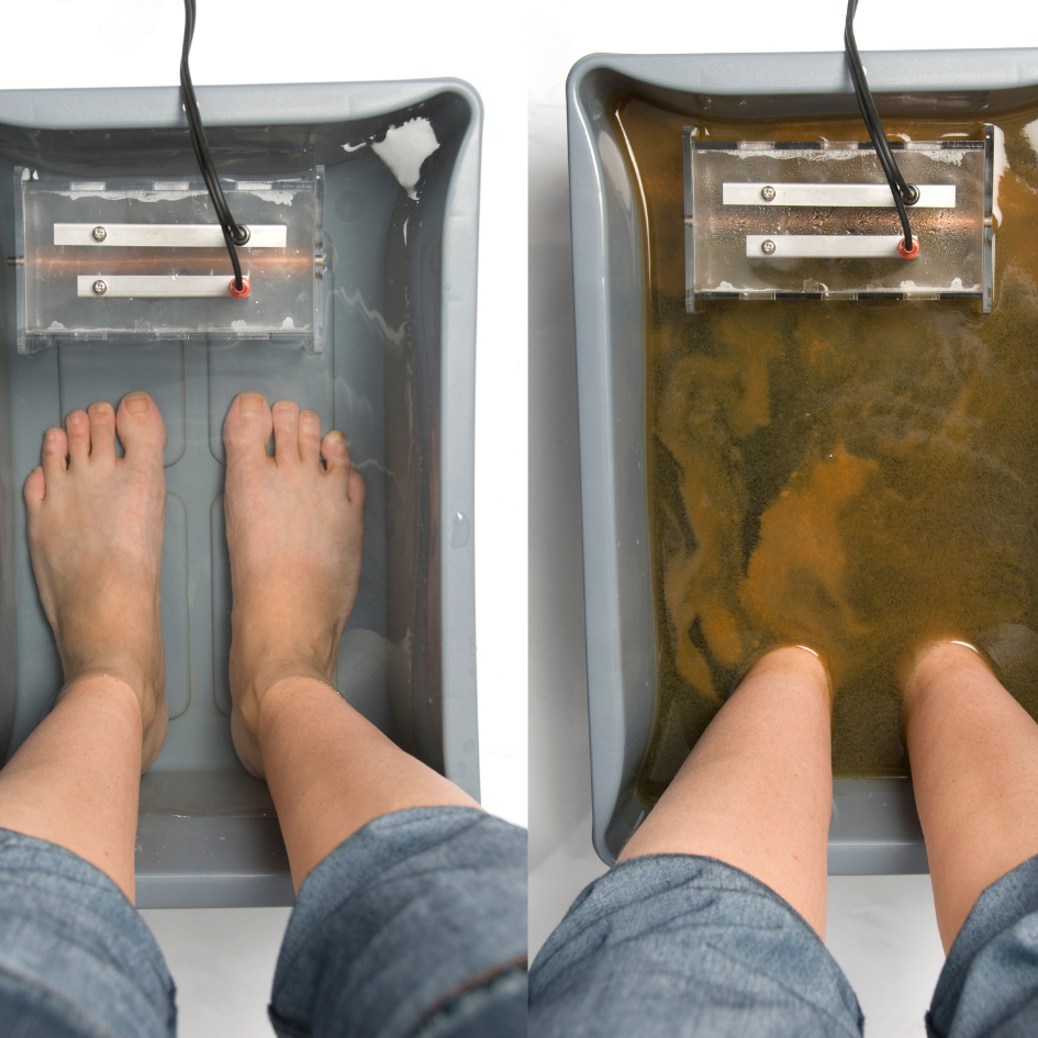 Desintoxicación Iónica